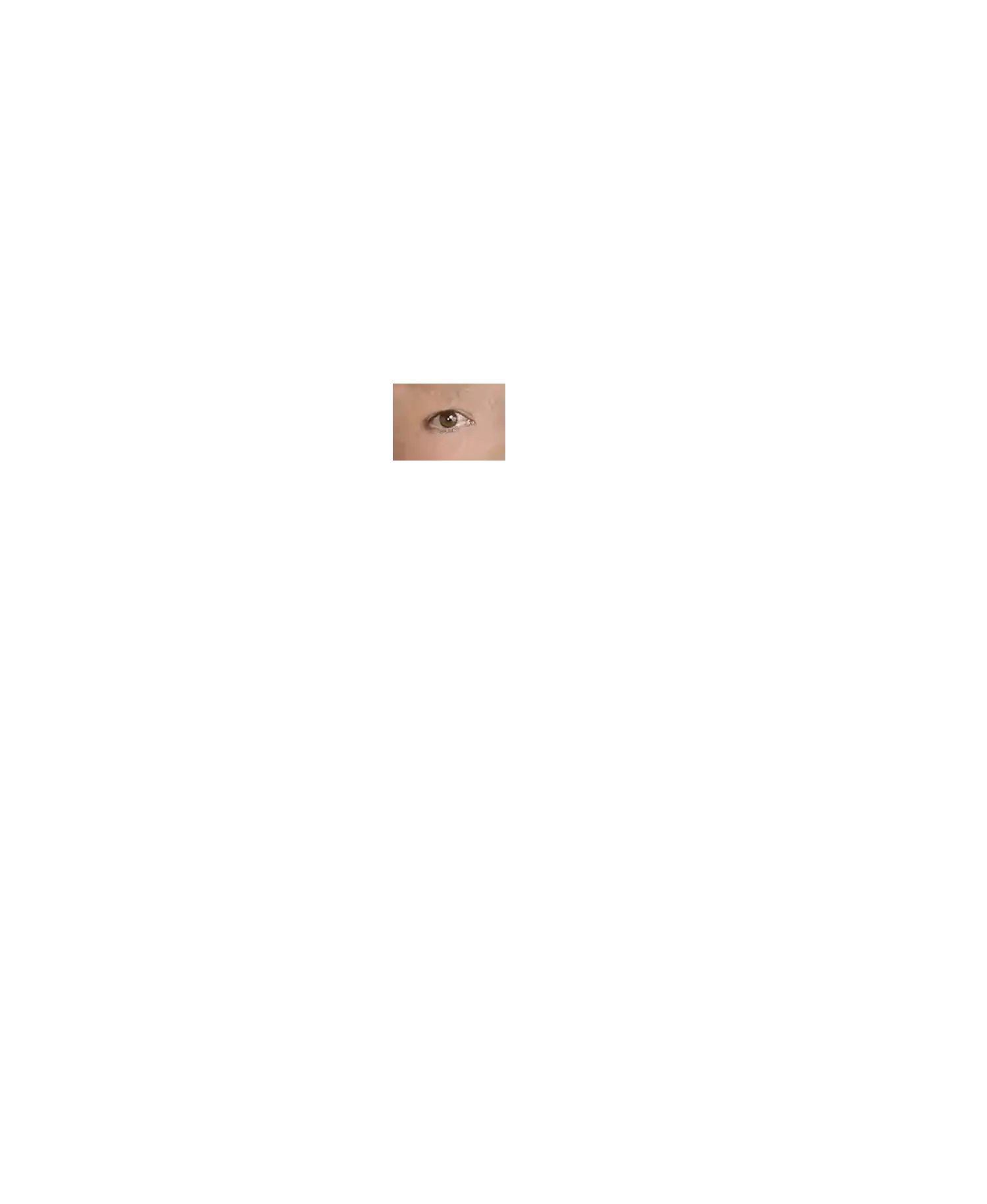 Left Eye