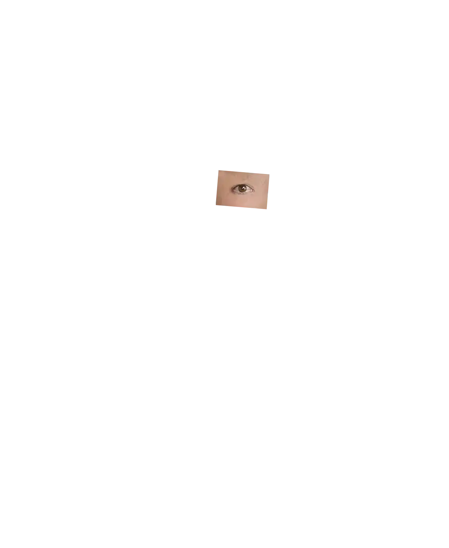 Right Eye